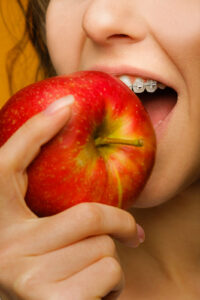 A patient wearing braces, eating an apple
