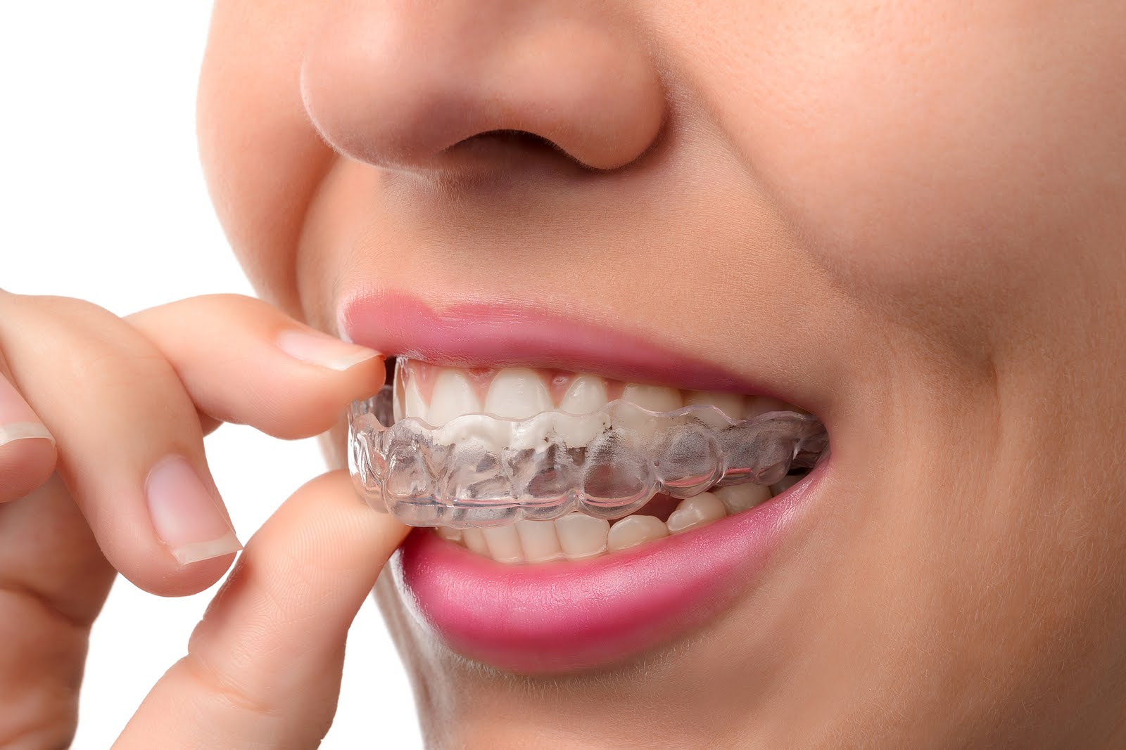 Invisalign clear aligners for sensitive teeth