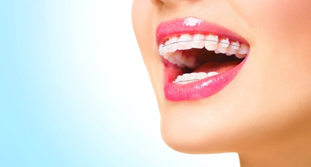 Orthodontic options for sensitive teeth